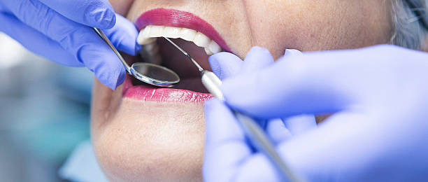Best Emergency Root Canal Therapy in Marshall, TX